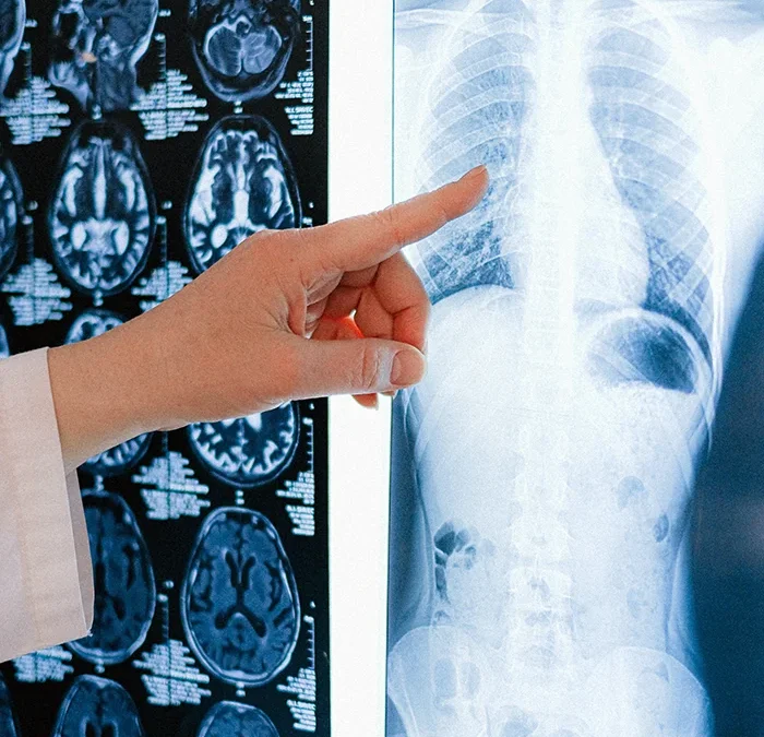 Illustration imagerie médicale – Maison de Santé Medivie à Templeuve-en-Pévèle